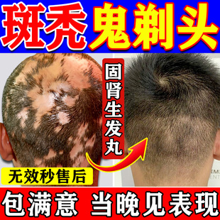 白发治转黑根中药补肾固精强肾男女肝肾同补益气养血生发丸补气血