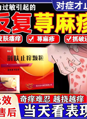 荆肤止痒颗粒官方旗舰店正品治疗荨麻疹特新效中成药过敏止痒药