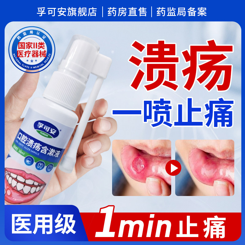 孚可安口腔溃疡含漱液喷剂嘴巴上火起泡烂嘴角口疮炎症牙龈肿痛