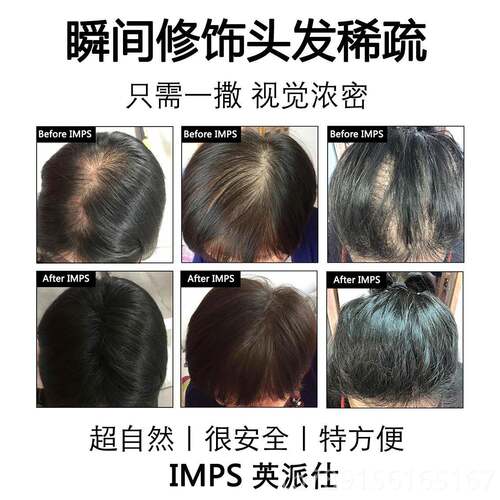 新款IMPS发际 线填充浓密增美发补发线神密发增发假发器多粉头发