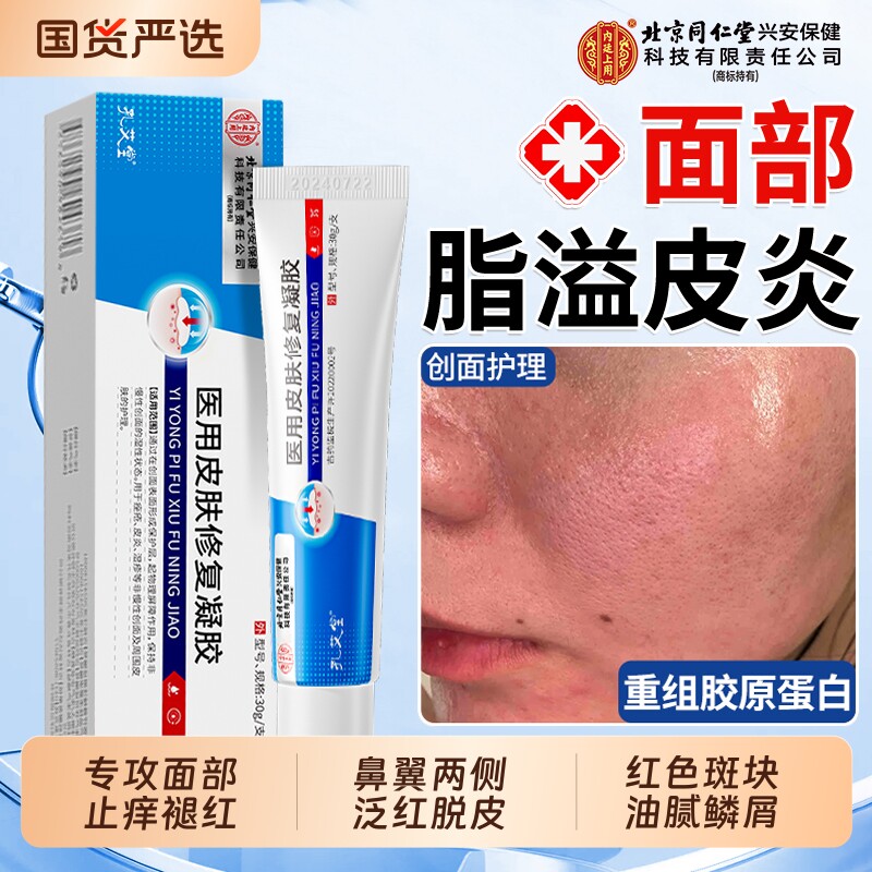 北京同仁堂医用脂溢性皮炎面部软膏修复鼻翼面部两侧泛红痒外止痒