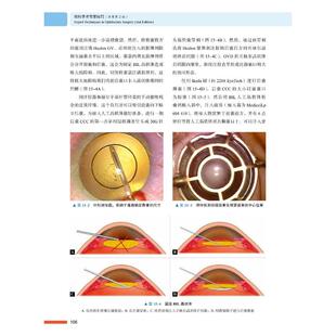 眼科手术专家技巧9787504691781中国科学技术出版社(印)帕鲁尔·伊什普贾尼,(美)乔治·L.斯佩斯,(美)迈伦·亚诺夫