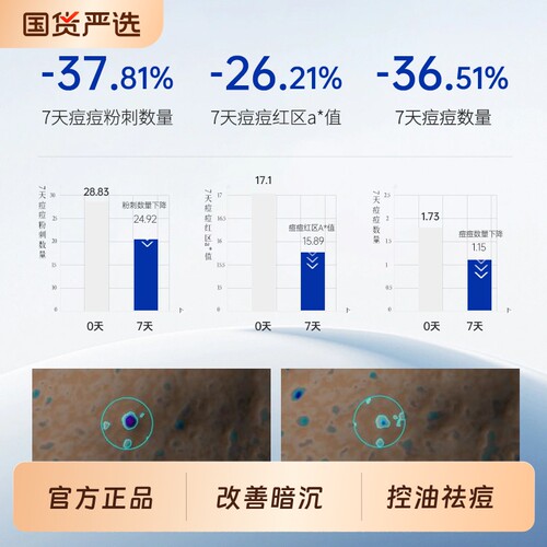 抛光水宫教授烟酰胺后背祛痘喷雾嫩肤除螨去角质护肤补水果酸控油