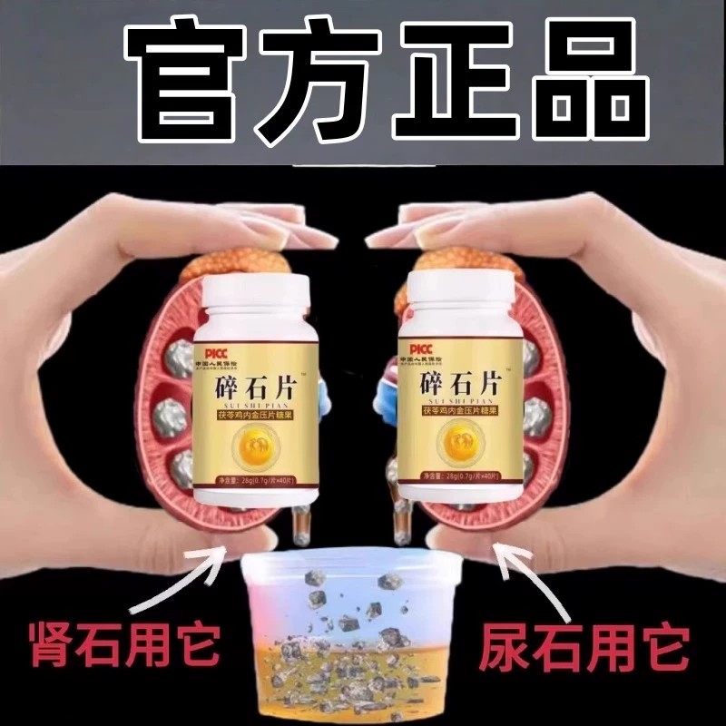 石头消失鸡内金碎石丸排石化石溶石尿管胆囊膀胱肾石胆结石鸡内金