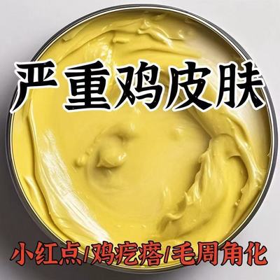 【官方正品】鸡皮肤疙瘩毛囊角化角质鱼鳞蛇霜干燥起皮去除神器