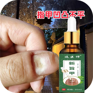 指甲凹凸不平修复凹坑小坑手指甲变形凹凸不平修复手指甲凹凸不平