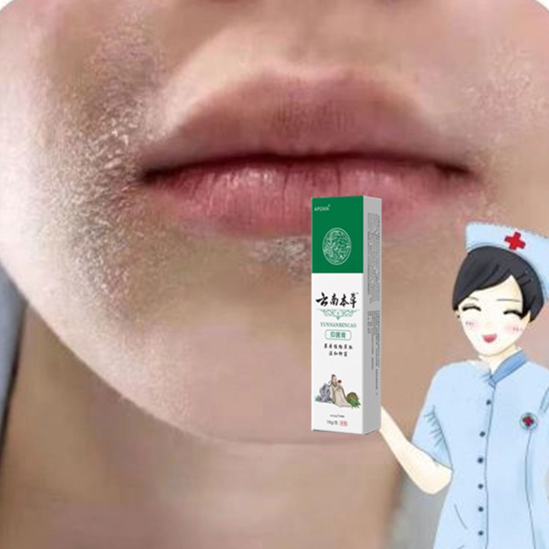 嘴周掉屑脸部干燥起皮掉皮掉皮脸爆皮起皮皮肤粗糙换季干燥季节性