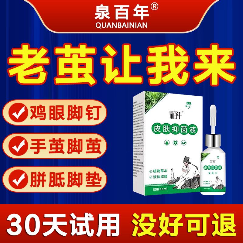 去老茧脚茧厚茧子硬皮治脚垫的药