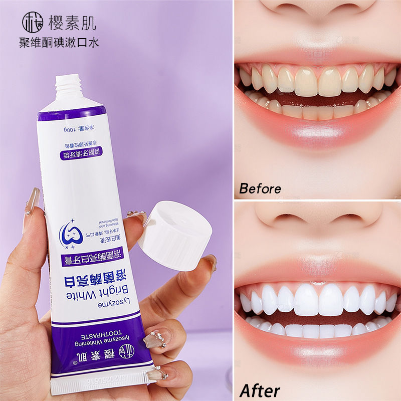 正品樱素肌溶菌酶亮白牙膏去渍