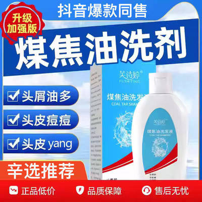 煤焦油洗剂1%抑菌去屑止痒清洁