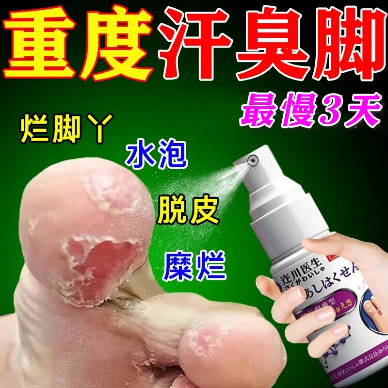脚气药臭根外治止痒真菌感染水泡脚气专医用药膏脚痒脱皮烂脚丫
