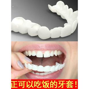 吃饭神器 成人男女通用缺牙牙缝大防塞牙遮丑硅胶套 真牙齿