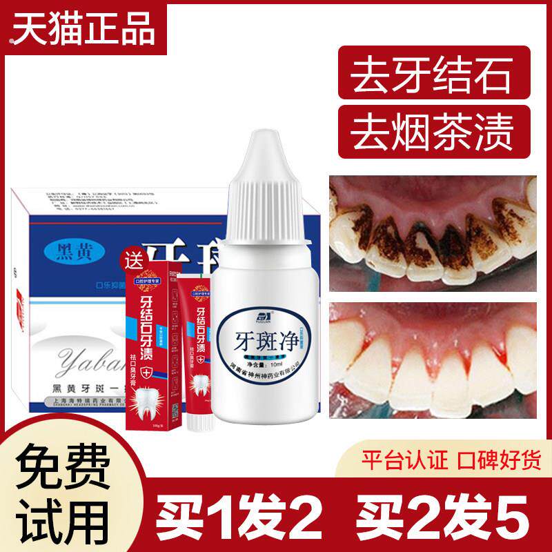 牙齿清洁工具牙结石溶牙渍器去除牙石速效洗牙神器清除牙垢菌斑