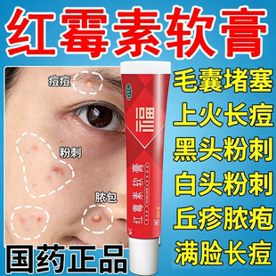 红霉素软膏消炎杀菌皮肤感染真菌痤疮化脓抗菌脓包痘痘私处外用