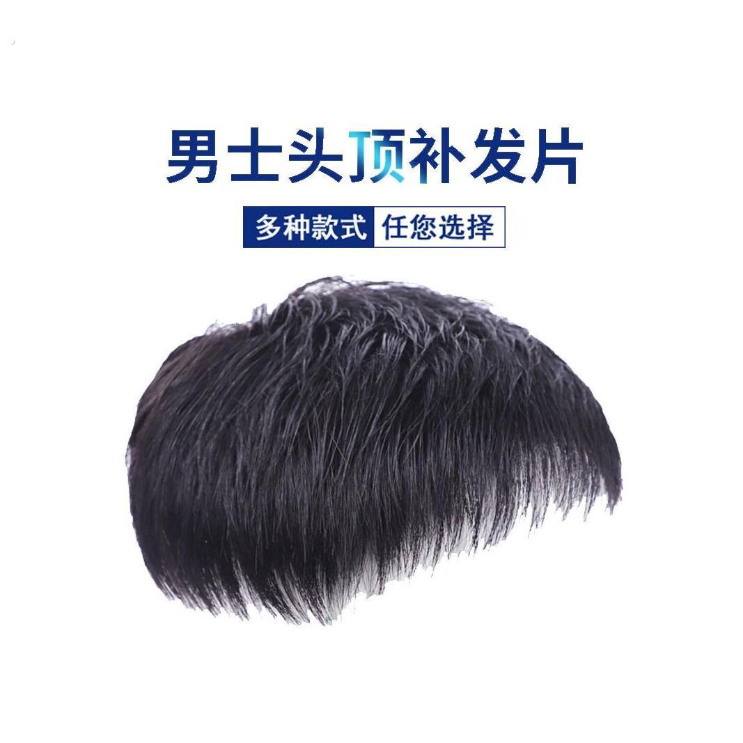 男士补发片假发套头顶补发前额秃顶补发垫接发翻盖假发真发男发块