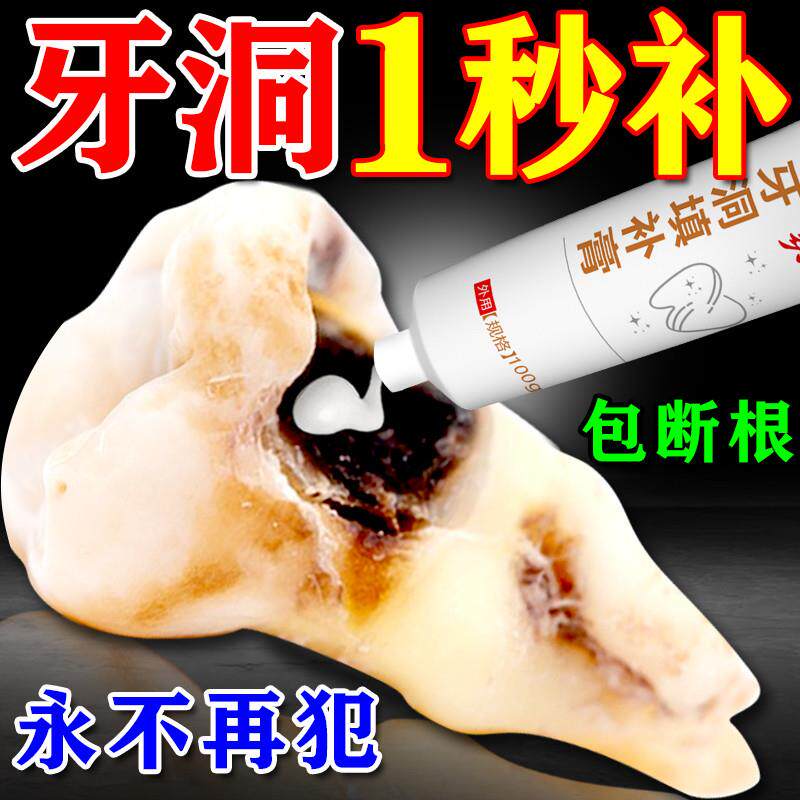 修覆牙洞填补牙齿洞膏补牙缝隙神器自己填充剂蛀牙清理牙虫的药