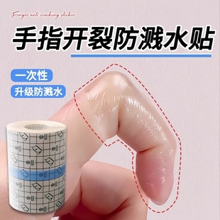手指防裂贴防过敏受伤手指头保护套透明防磨自粘指套防开裂防划伤