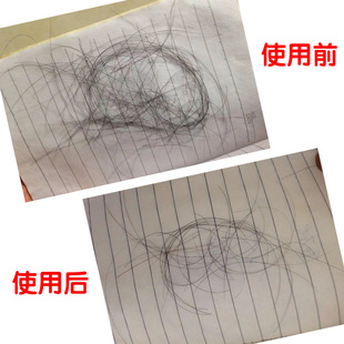 生发帽子梳神器防脱发密增发固发毛囊激活激光生R发仪红光护理头