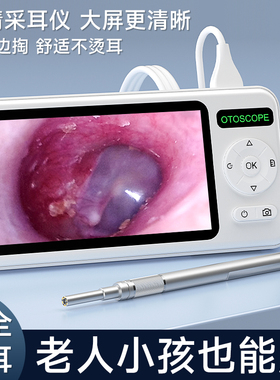iTiMo高清可视专业采耳仪器发光挖耳勺耳镜耳鼻喉内视镜掏耳神器