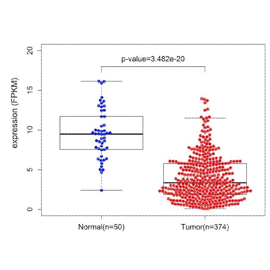 TCGA数据库差异表达(生物信息学/单个基因/geo数据库/lncRNA)