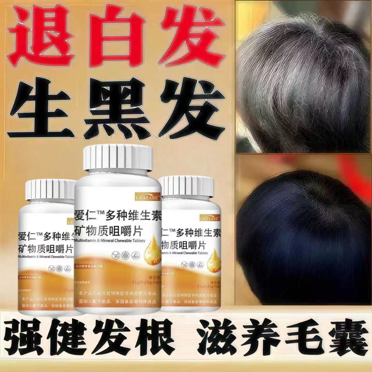 梦思宁维生素B内调白发脱发