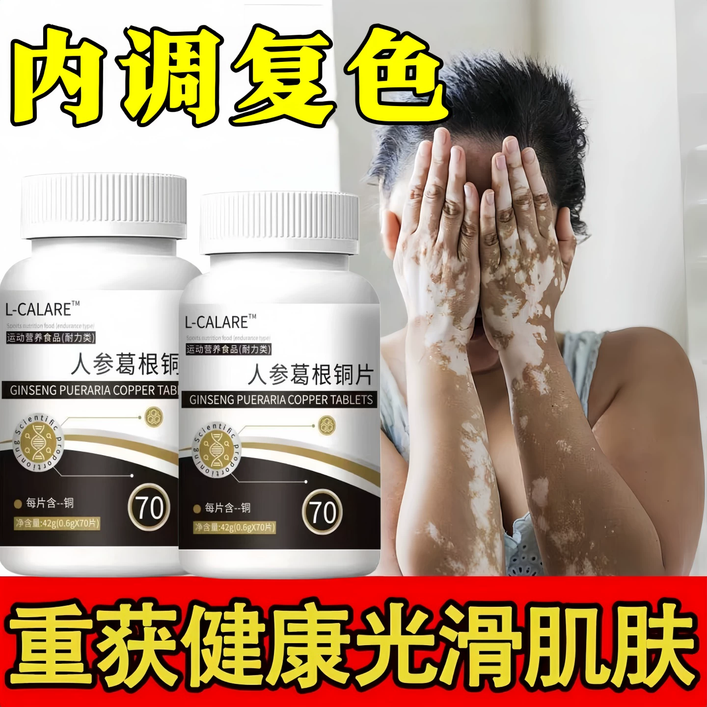 杜泰克铜片微量元素补充白斑肤色