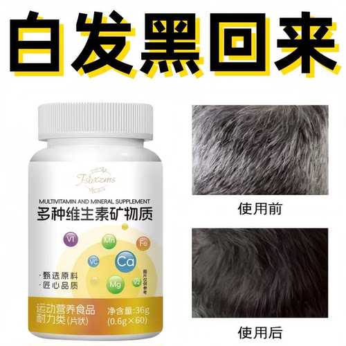 艾弗维生素B族乌发素白发脱发