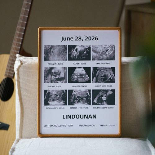 B超相框挂墙diy照片定制加打印来图洗照片宝宝孕育新生纪念框制作