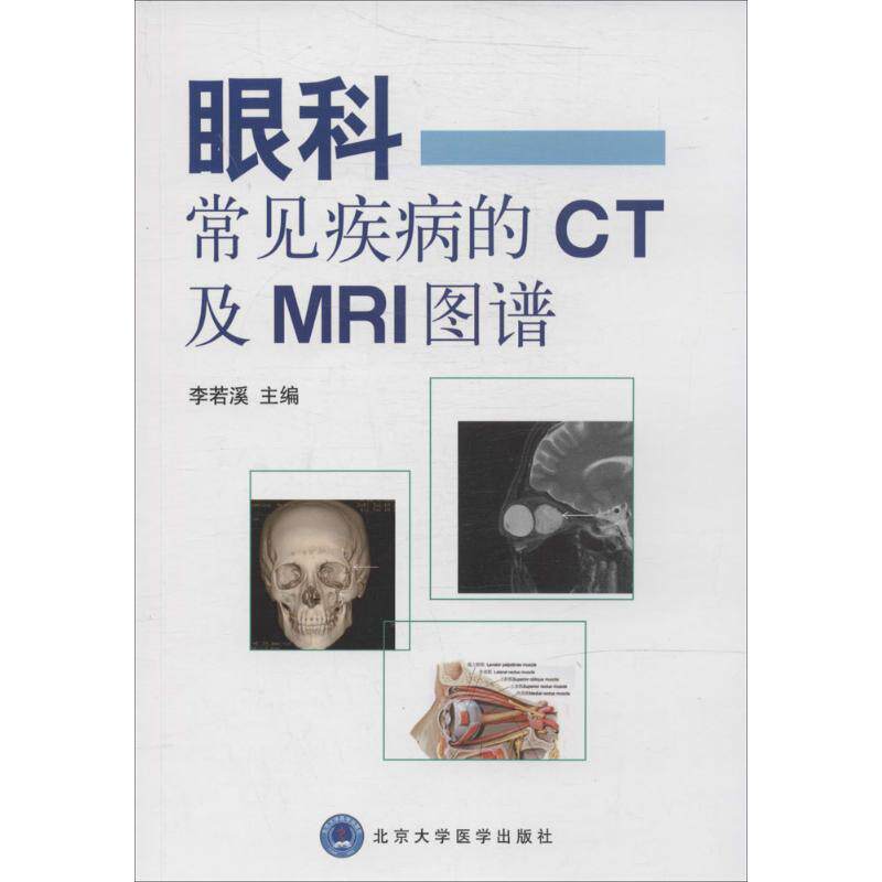 【正版书籍】眼科常见疾病的CT及MRI图谱李若溪著北京大学医学出版社9787565908392