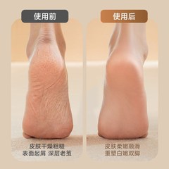电动磨脚器充电插电式自动磨脚皮去脚皮死皮老茧磨脚神器修足机