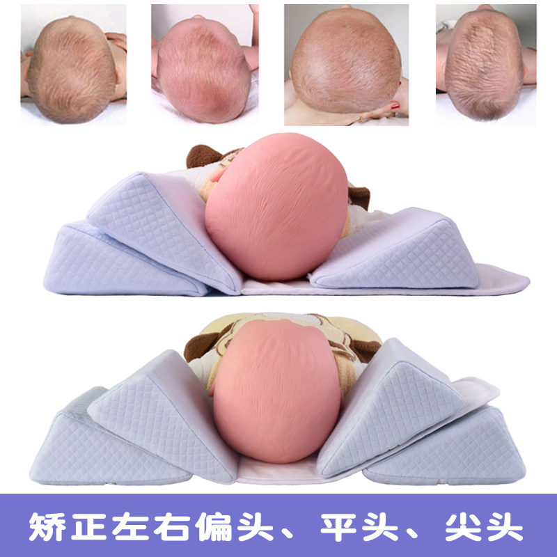 婴儿矫正定型枕宝宝纠正q头型新生儿侧睡枕防偏头尖头扁平头0-6-1