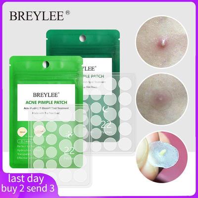 Acne Pimple Patch Stickers Acne Treatment Pimple Remover To