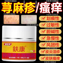 寻荨麻疹过敏止痒断专用治胆碱急慢性高免疫力皮肤瘙痒药膏