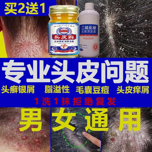 治头皮癣银屑脂溢性皮炎毛囊炎结痂鳞屑头部真菌专用药膏洗发水