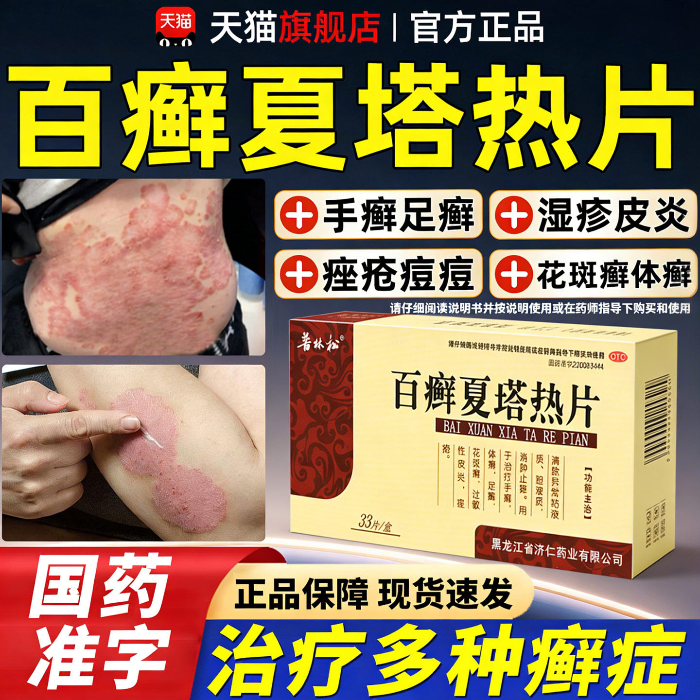 百癣夏塔热片正品止痒胶囊治疗顽固牛皮癣银屑专用药官方旗舰店