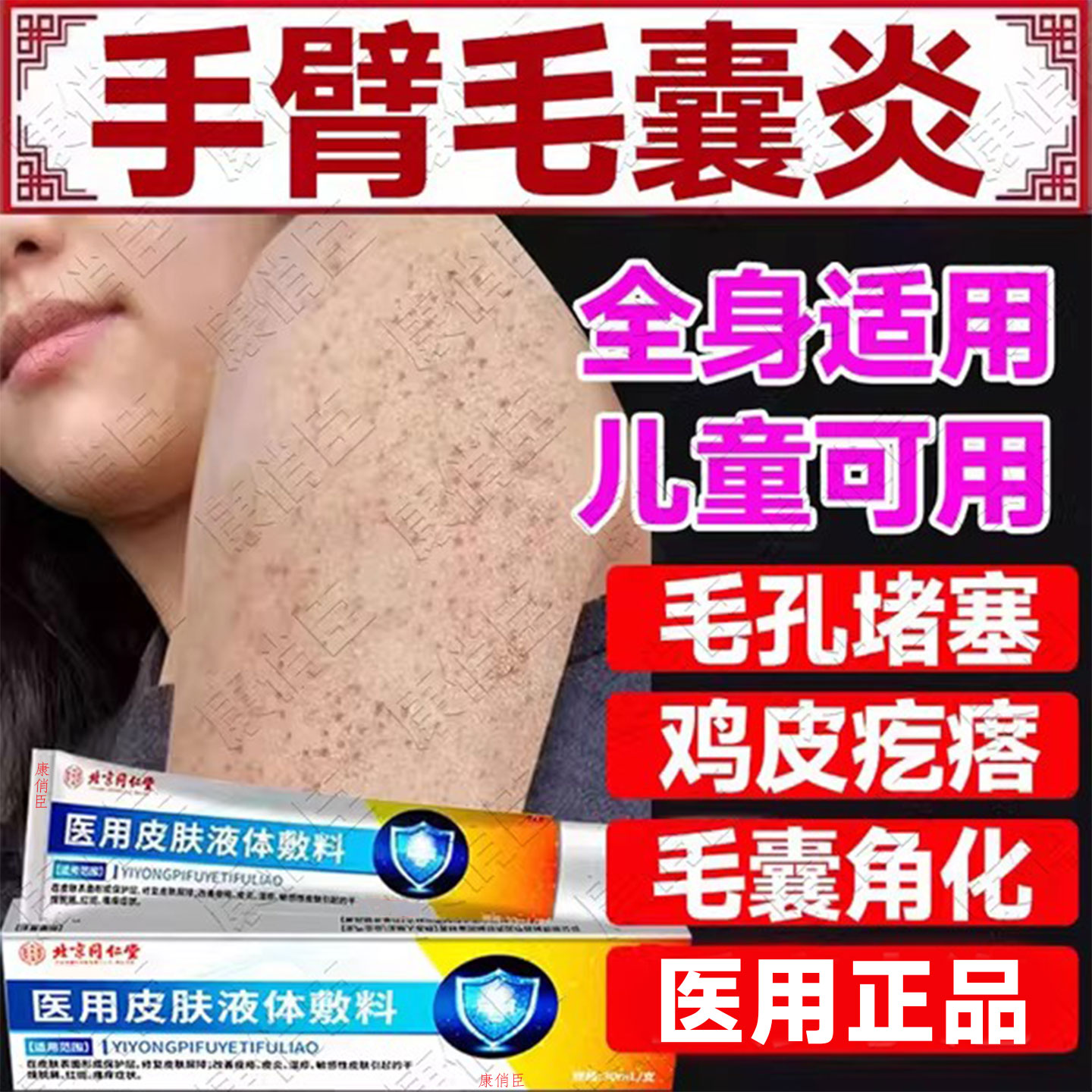 手臂毛囊炎胳膊上长疙瘩鸡皮肤角化症专角质用脂肪小颗粒药监备案