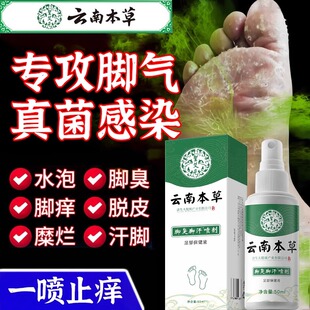 去脚气喷雾止痒根脱皮杀菌水泡烂脚丫香港脚糜烂专脚趾缝痒用特效