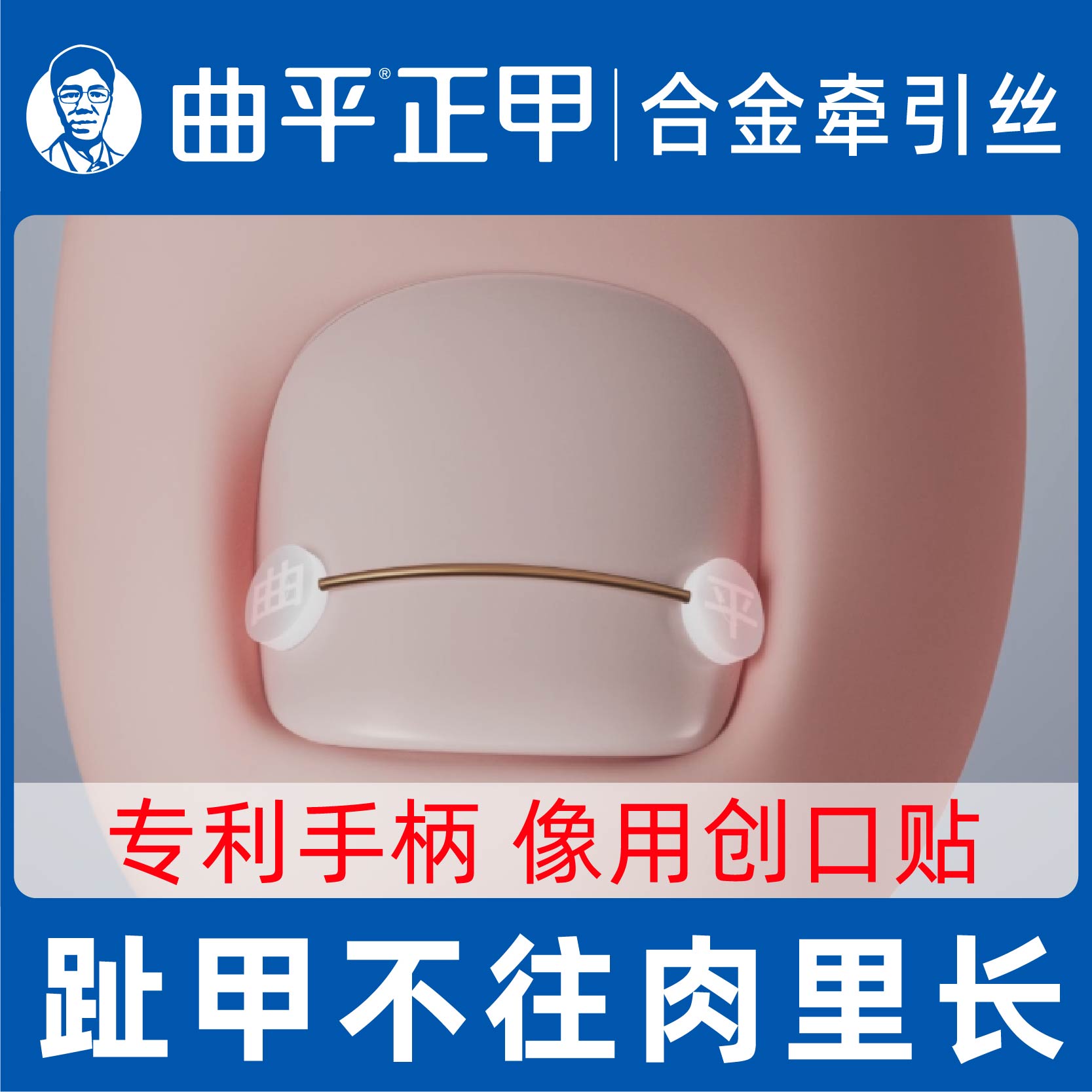 曲平医生 甲沟脚指甲嵌甲矫正器趾甲正甲贴片钢丝纠正神器炎足科