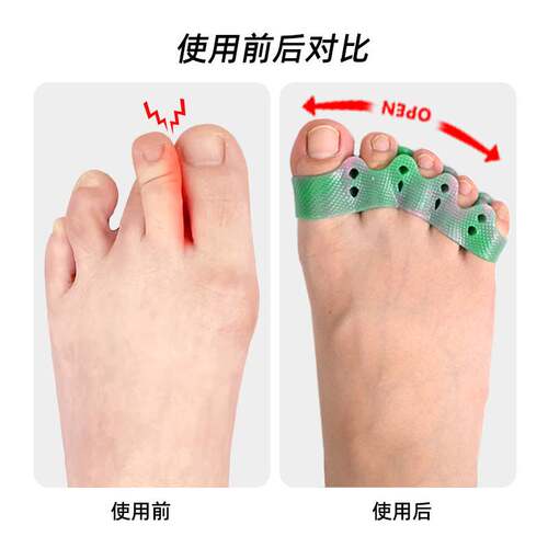 彩色五孔分趾器SEBS拇指外翻大脚骨重叠趾脚趾分离器五孔分离垫