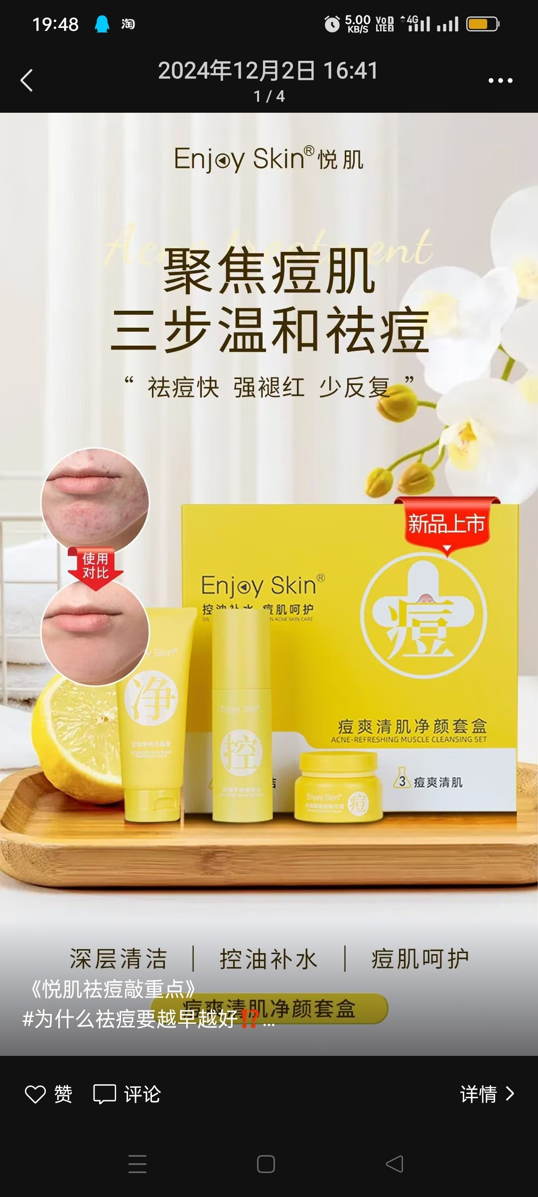 新品上市正品包邮enjoy s面部护理套装