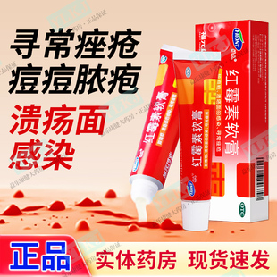【药房正品】福元红霉素软膏10g治皮肤溃疡面感染寻常痤疮脓疱疮