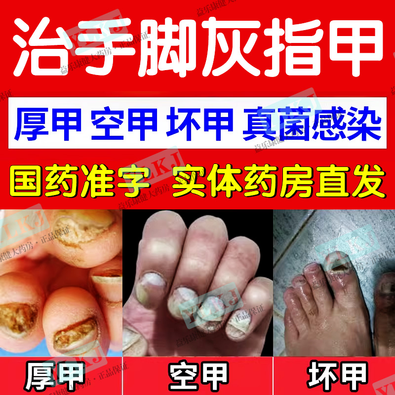 【太平】硝酸咪康唑乳膏2%*10g*1支/盒