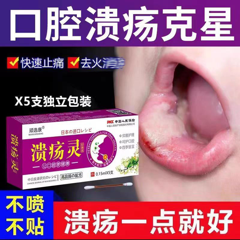 正品腔专用一点灵棉棒牙龈肿痛疮烂舌头烂嘴巴舌头生疮口起泡专用