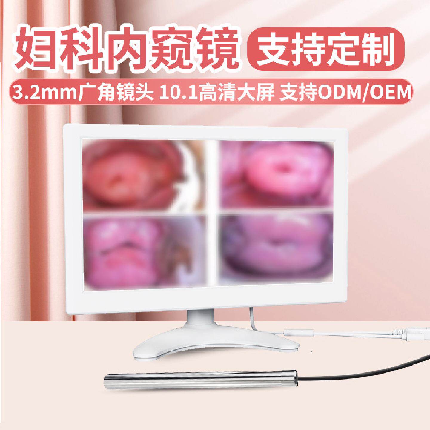厂家直销女性可视内窥镜妇科阴道镜宫颈检查仪器私密自检镜批发