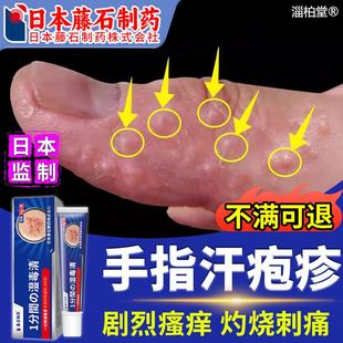 日本品牌汗疱疹可搭膏药贴手上起小水泡止瘙痒干裂脱皮真菌感染HV