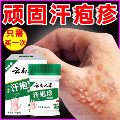 云南本草植萃汗泡疱真菌感染膏