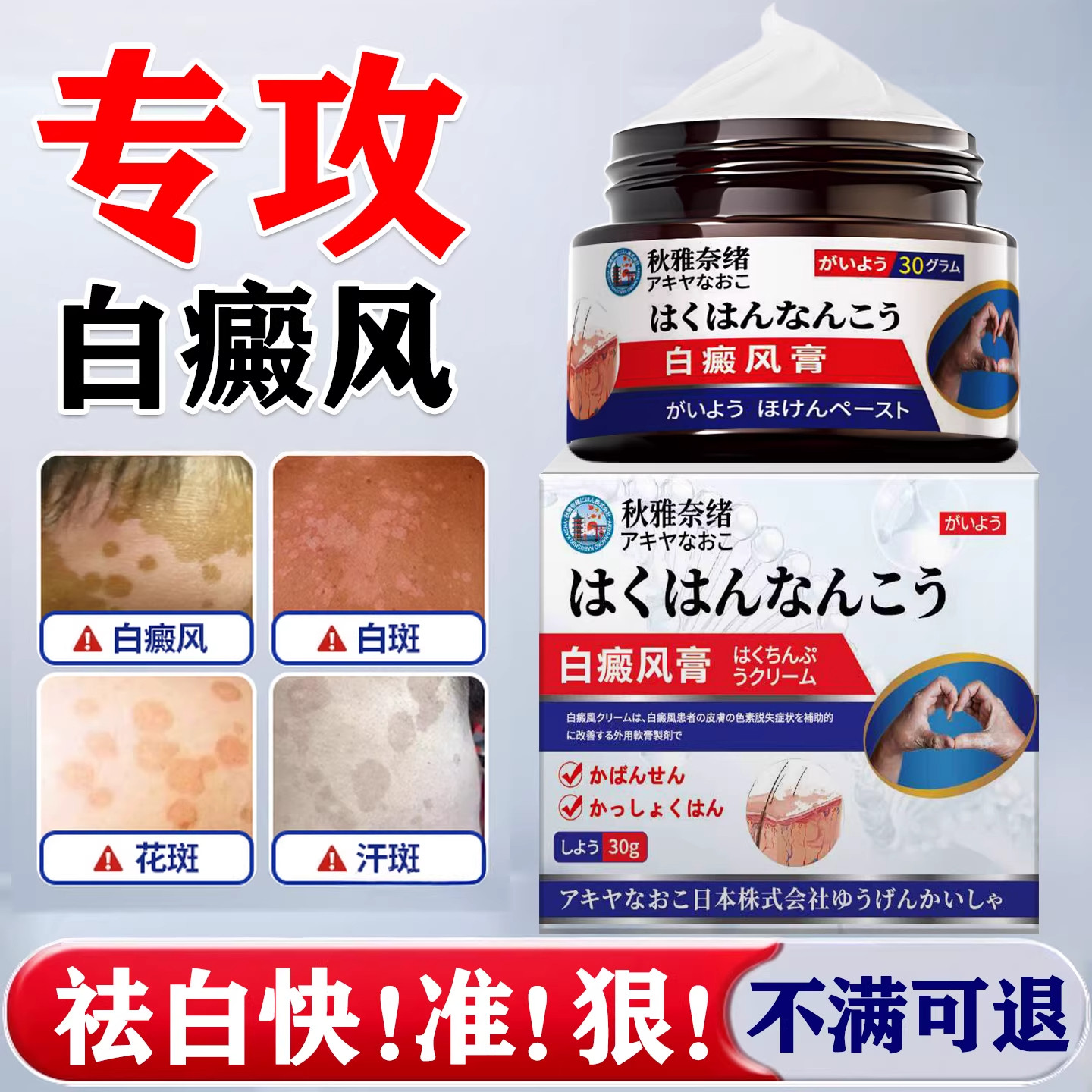 白癜风膏快速消白斑补骨脂酊白癜风白斑促进黑色素生长遮瑕外用膏