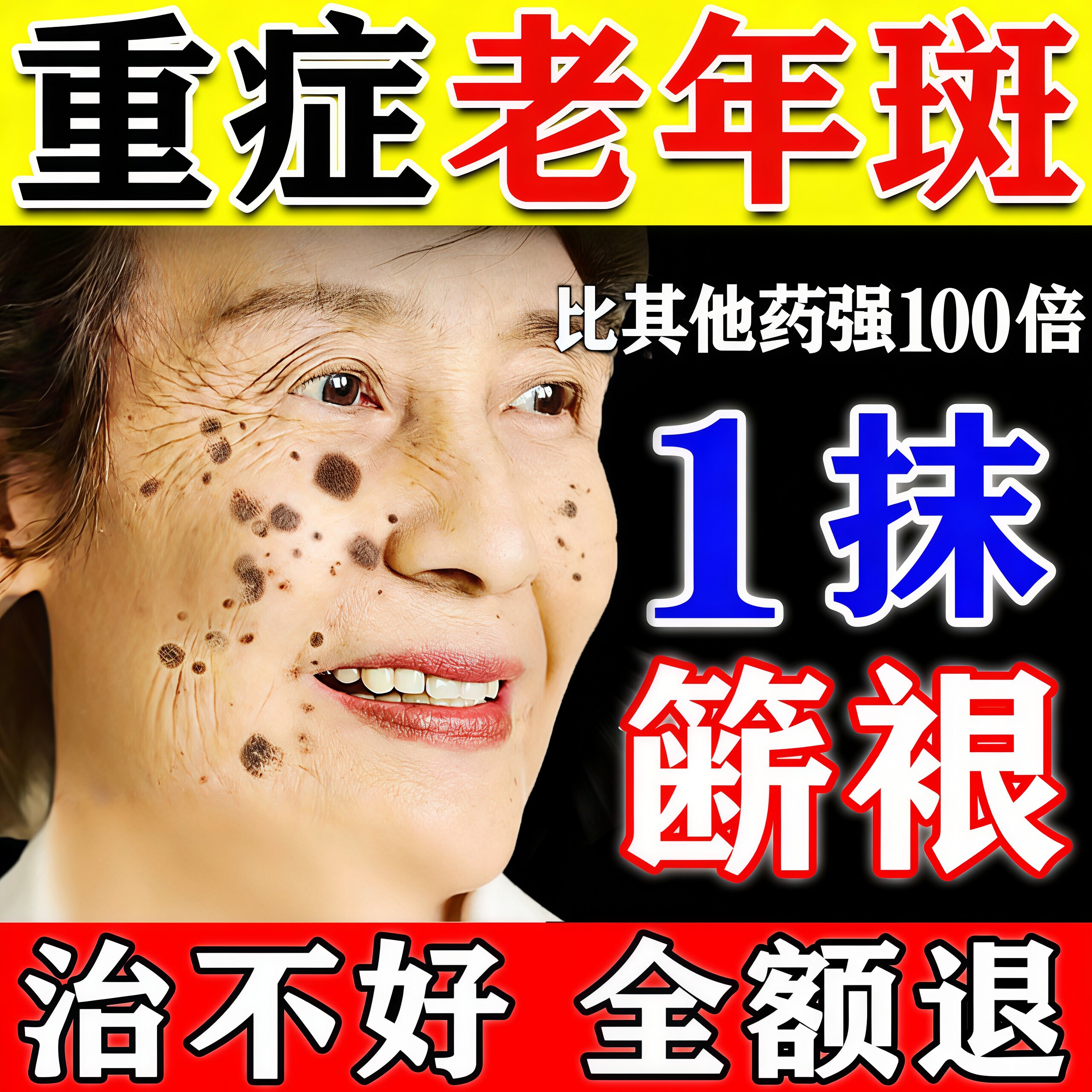 老年斑美白祛斑霜黄褐专用膏药强力去手部除脸部一擦就掉中老年人