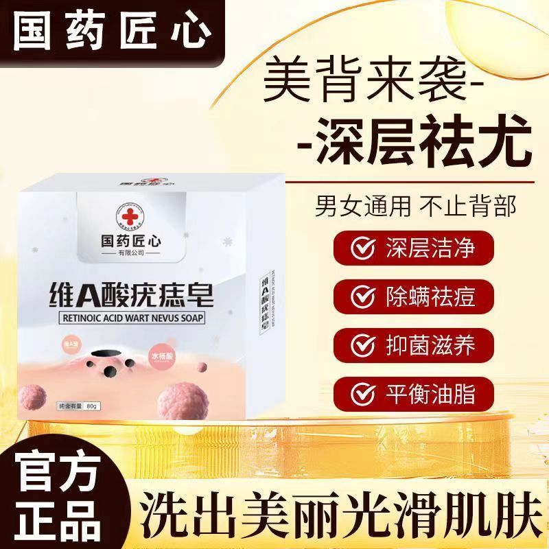 维a酸疣痣皂去疣药皂旗舰店肤康皂除螨身上小肉粒皂去祛清除克疣