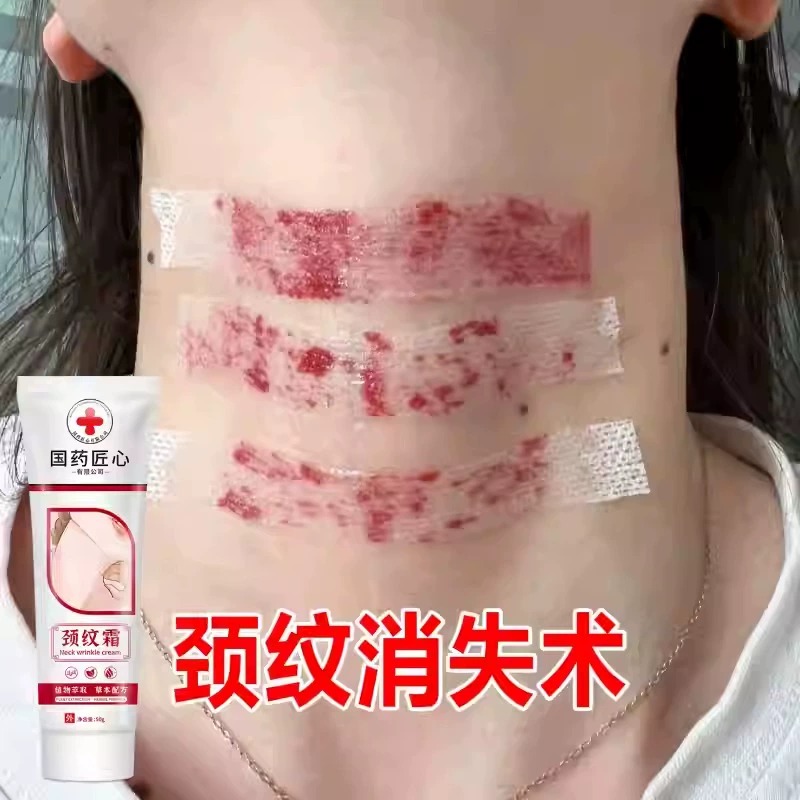 【还你天鹅颈】别让颈纹暴露了你的年龄 淡化颈纹细纹神器颈纹霜